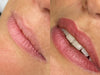 VOORSCHOT - STARTER I Module Full lips